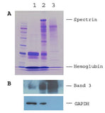 Minute™ Plasma Membrane Isolation Kit for Mammalian Red Blood Cells (20 preps)